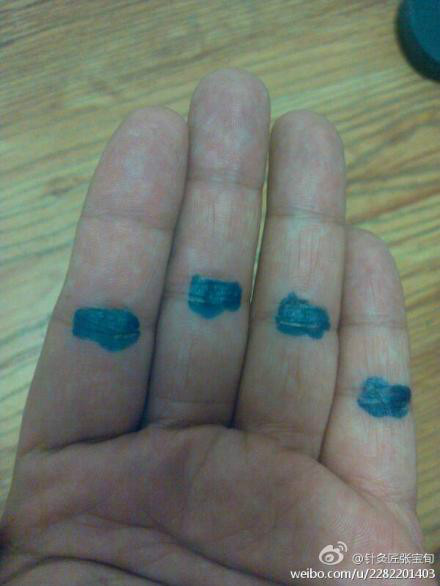 ��Ľ��ű�Ѯ����ҽѧ�ط����ܼ򵥣���Ч��! - Եˮ���� - 