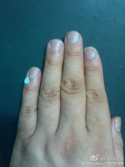 ��Ľ��ű�Ѯ����ҽѧ�ط����ܼ򵥣���Ч��! - Եˮ���� - 