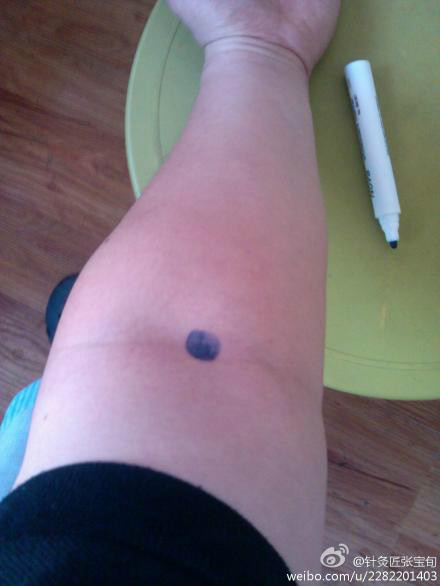 ��Ľ��ű�Ѯ����ҽѧ�ط����ܼ򵥣���Ч��! - Եˮ���� - 