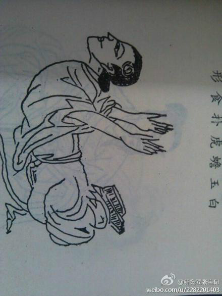 ��Ľ��ű�Ѯ����ҽѧ�ط����ܼ򵥣���Ч��! - Եˮ���� - 