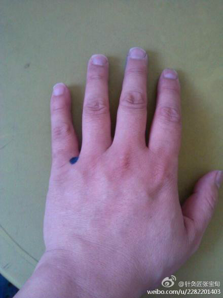 ��Ľ��ű�Ѯ����ҽѧ�ط����ܼ򵥣���Ч��! - Եˮ���� - 