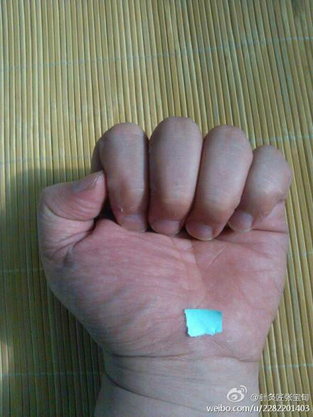 ��Ľ��ű�Ѯ����ҽѧ�ط����ܼ򵥣���Ч��! - Եˮ���� - 